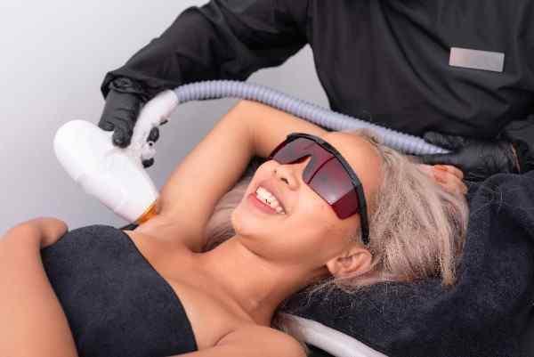 laser hair removal