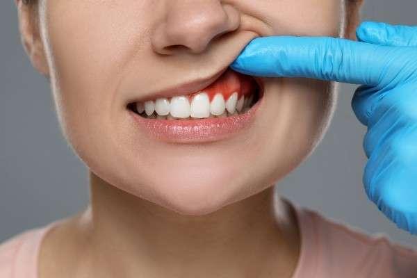 Emergency dentist in Norwich