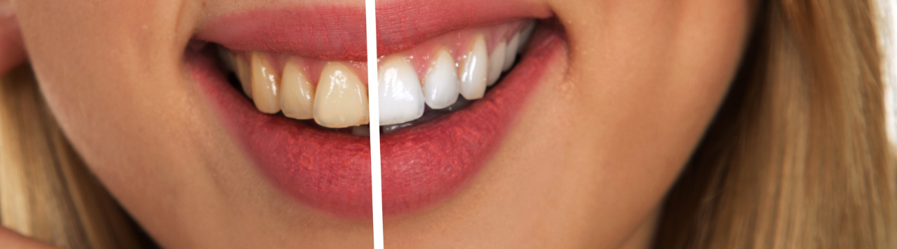 Mayfield Dental