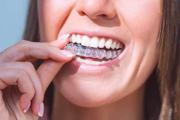 orthodontist Braintree