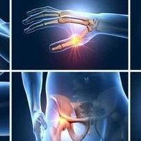Arthrovit Arthrovit