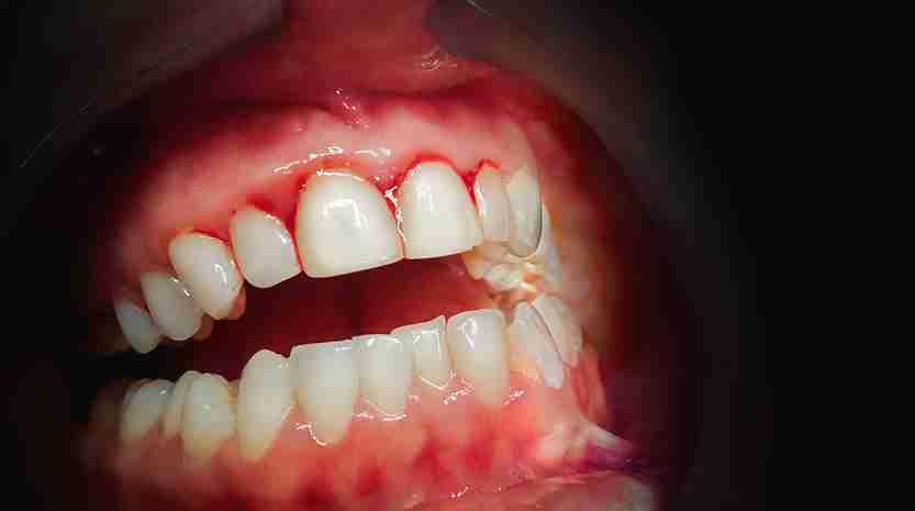 emergency dentist in Derby