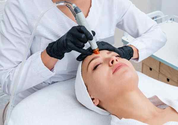 Laser Hair Removal in Slough