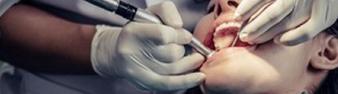 Wisdom Teeth Removal