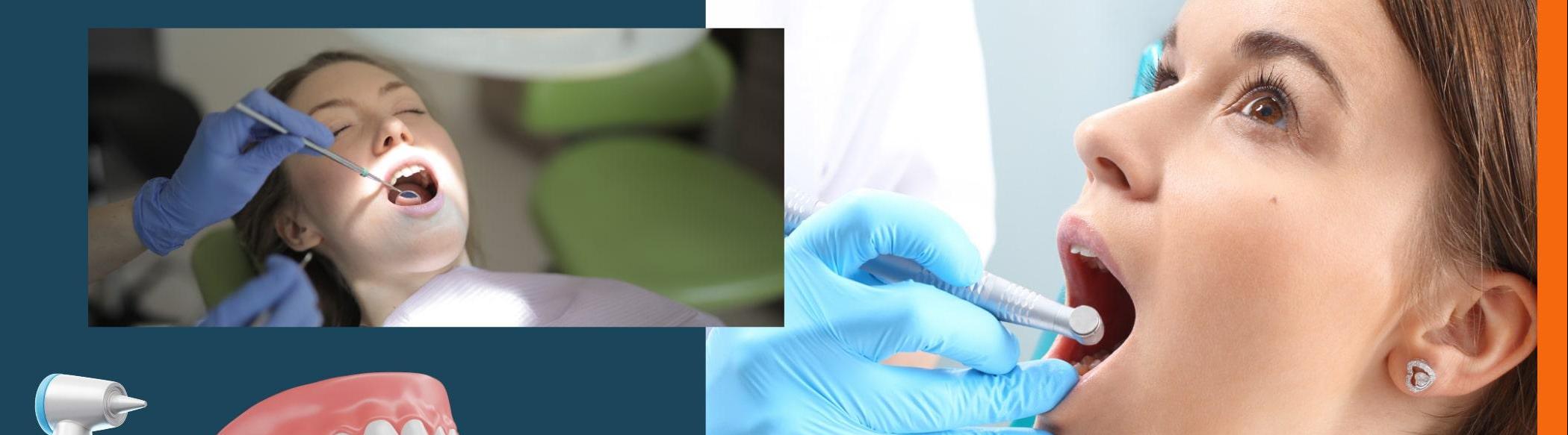 Easy Root Canal