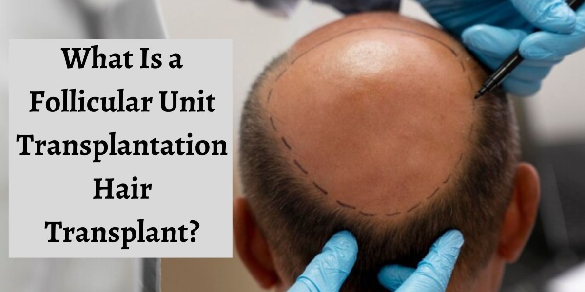 What Is a Follicular Unit Transplantation Hair Transplant?