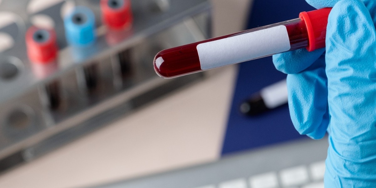 The Importance of CBC Blood Tests Before Surgery: Key Insights for Your Health