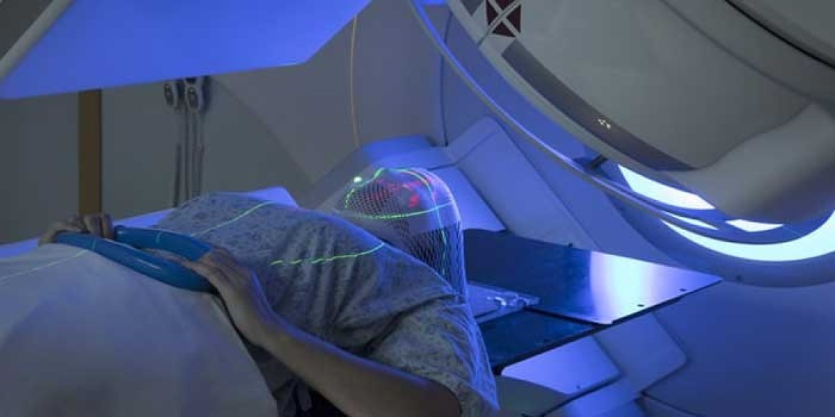 Can Radiation Therapy Cure Cancer? Understanding Its Role in Treatment